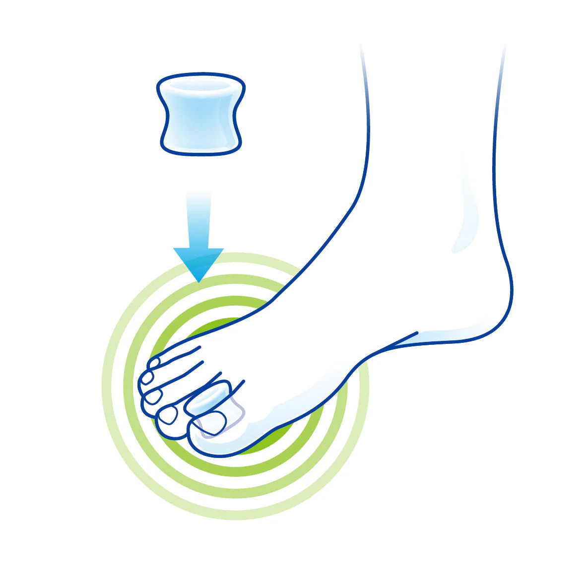 LP Support Hallux Straighteners 327 - Image 2