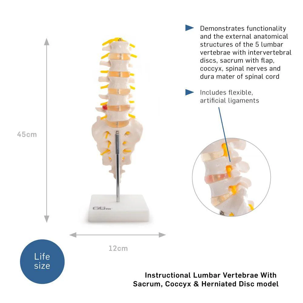66fit Anatomical Lumbar Vertebrae With Sacrum/Coccyx/Herniated Disc - Image 5