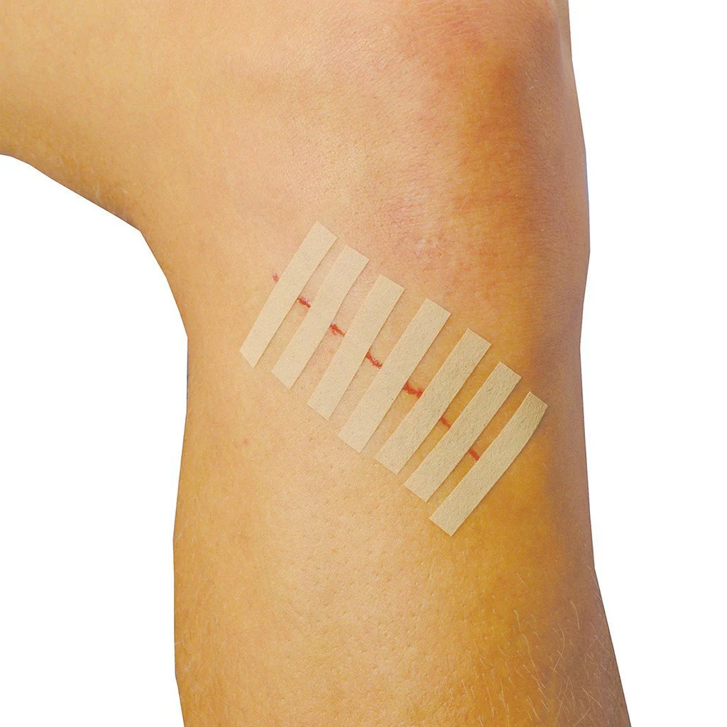 3M Steri Strips - Box of 50 - Image 2